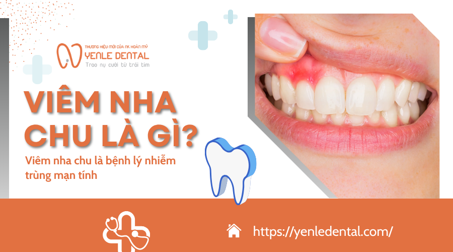 viêm nha chu là gì